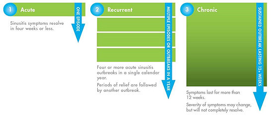 Sinusitis